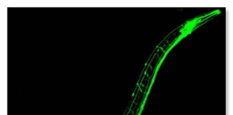 El Centro de Investigación del Cáncer estudia la apoptosis en el gusano C. elegans