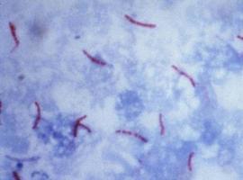 La epidemia de tuberculosis en China deriva de una expansión bacteriana hace mil años