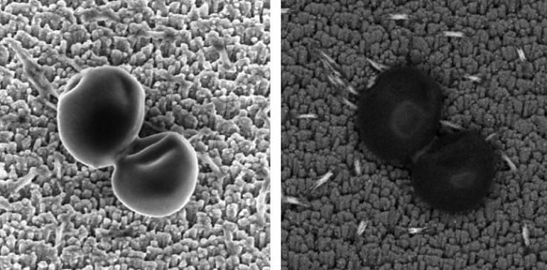 Un equipo del CSIC logra nanoestructuras para proteger los implantes de las infecciones