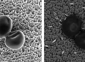 Un equipo del CSIC logra nanoestructuras para proteger los implantes de las infecciones