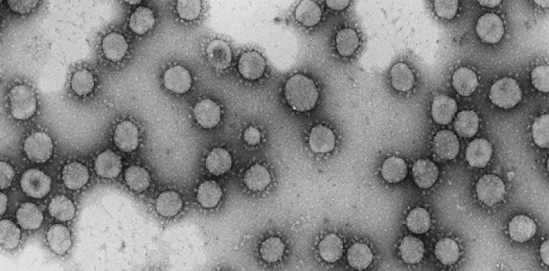 El CSIC impulsa un proyecto para predecir la evolución del nuevo coronavirus