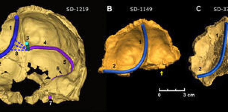 El Sidrón descubre que el cerebro neandertal era más asimétrico que el del Homo sapiens