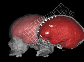 Analizan la influencia en la evolución humana de la anatomía interna del cráneo y el hueso frontal