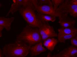 Una proteína clave para frenar el avance de un cáncer de hígado con alta mortalidad