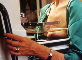 Madrid realizará unas 420.000 mamografías en unidades móviles hasta 2015