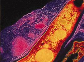 Las bacterias más raras escapan a la detección