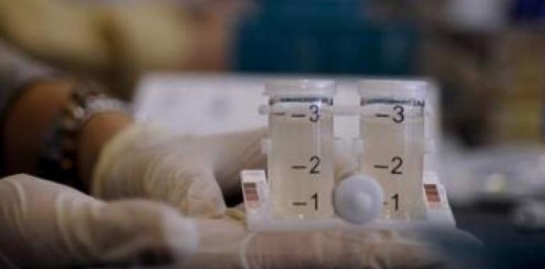 Biótica certifica a nivel internacional su test para la detección rápida de Legionella pneumophila