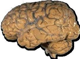 Dilemas éticos en las investigaciones sobre el cerebro