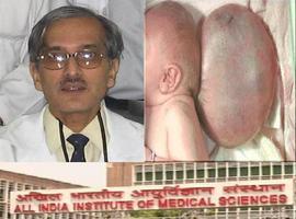 Médicos indios eliminan con éxito una protuberancia gigante en la cabeza de un bebé