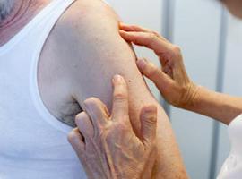 Europa aprueba la primera terapia personalizada para el melanoma avanzado