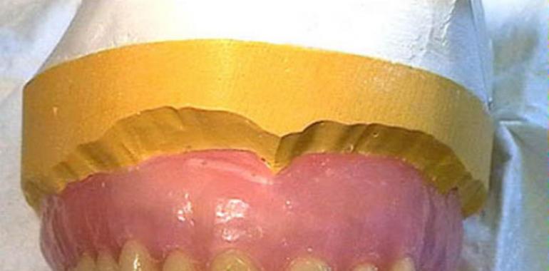 Así se mejora la adherencia de los materiales para odontología