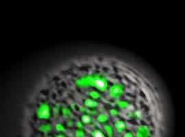Crean el primer láser celular con proteínas fluorescentes
