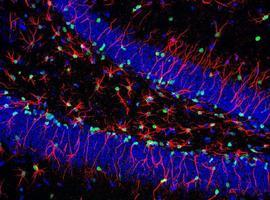 Solo algunas células madre son eficaces para la medicina regenerativa