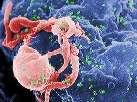 Investigadores españoles desarrollan la vacuna contra el VIH con mejor respuesta virológica