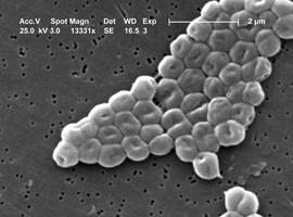 Un estudio determinará cómo se expande un brote de ‘Acinetobacter baumannii’