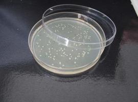 Respuesta a por qué las bacterias cada vez son más resistentes a los antibióticos