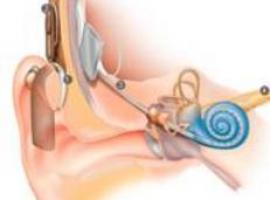 Casi 200 asturianos con discapacidad auditiva mejoran su vida tras un implante coclear en el HUCA 