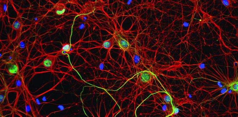 Una investigación analiza la sinapsis de las neuronas y su relación con el alzhéimer