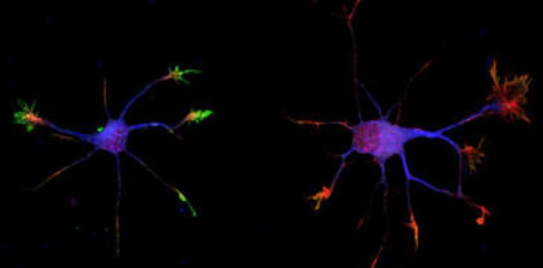 Identifican un nuevo regulador de la maduración neuronal y de la actividad sináptica