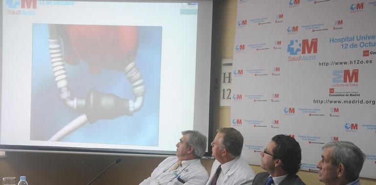 Cirujanos del 12 de Octubre implantan un corazón artificial como asistencia circulatoria permanente