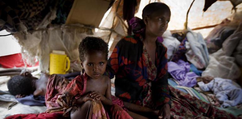 Somalia: el sarampión agrava la desnutrición, la falta de acceso a la salud y el conflicto 