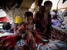 Somalia: el sarampión agrava la desnutrición, la falta de acceso a la salud y el conflicto 