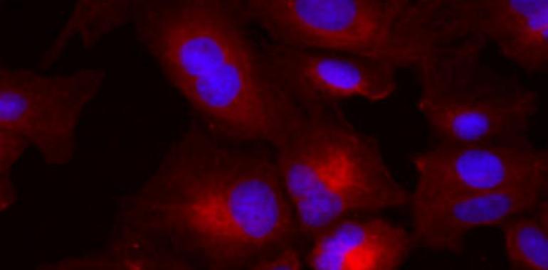 Una proteína clave para frenar el avance de un cáncer de hígado con alta mortalidad
