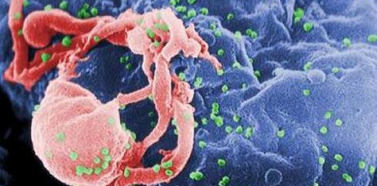 El VIH continúa replicándose pese a la medicación 