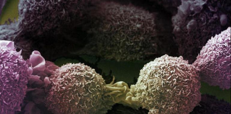 Nueva prueba predice la gravedad del cáncer