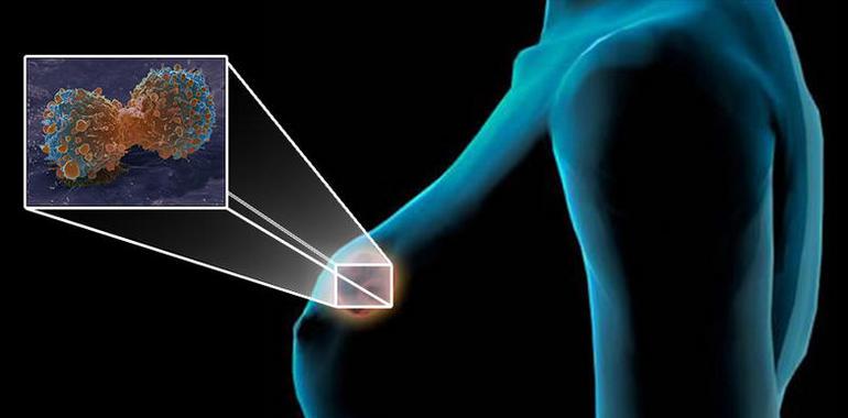 Microondas para una detección más precoz del cáncer de mama
