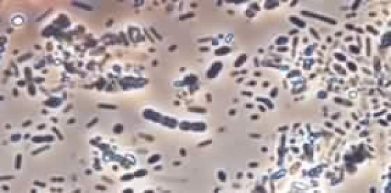 Identifican 43 genes de riesgo de padecer lupus eritematoso sistémico