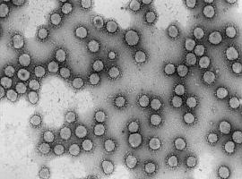 CSIC impulsa investigaciones para atajar el coronavirus 