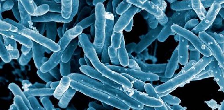 ¿Por qué no podemos acabar defintivamente con la tuberculosis