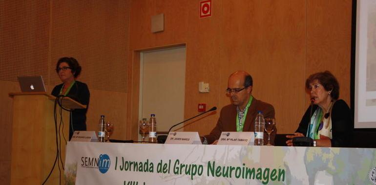 Las técnicas de neuroimagen intentan mejorar el diagnóstico del párkinson