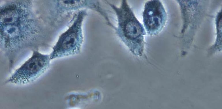 Un estudio del CSIC logra un avance revolucionario en la eliminación selectiva de células cancerosas utilizando jaulas moleculares