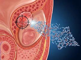 Nanopartículas inteligentes contra el cáncer de próstata: un avance revolucionario en la lucha oncológica