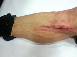 Así acabó la pierna de Mate Bilic tras el entrenamiento de hoy