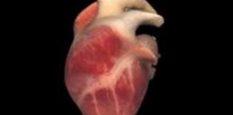 Descubierta una nueva vía de señalización celular para el desarrollo de la hipertrofia cardiaca 