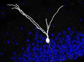 El CSIC descubre el mecanismo que controla el crecimiento de los axones