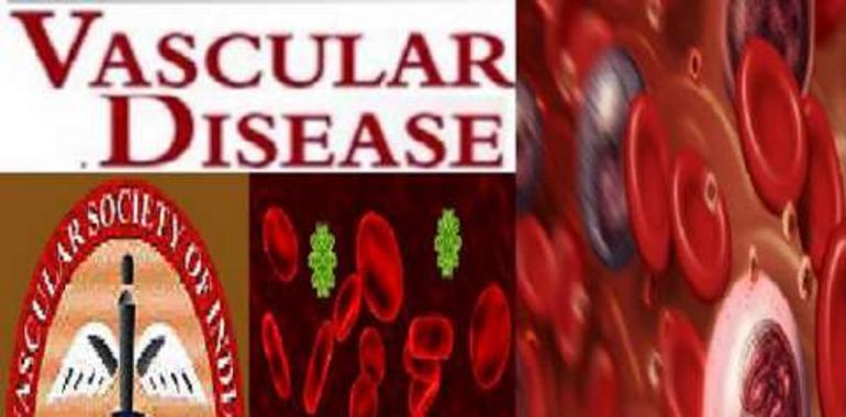  Vascular diseases in India increasing at alarming rate