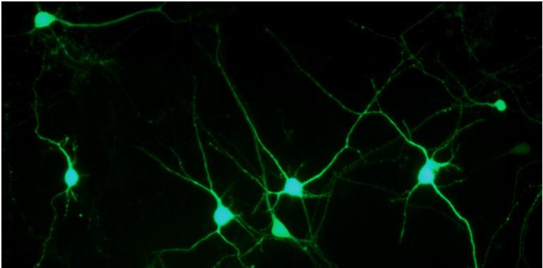 Estudian cómo estimular la generación de nuevas neuronas