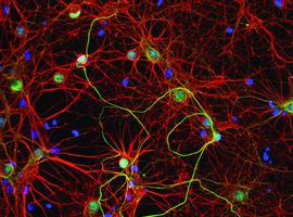 Colisiones neuronales al azar podrían explicar las diferencias cerebrales entre individuos 