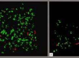 La sinapsis neuronal es cinco veces menor en las zonas del cerebro afectadas por  Alzheimer