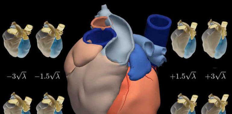 Los gijoneses podrán medir gratuitamente su riesgo cardiovascular durante toda la semana