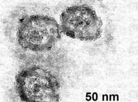 Encuentran cura para los peores casos de hepatitis C