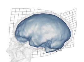 Limitaciones anatómicas y funcionales del cráneo de los neandertales: ¿Causa de extinción