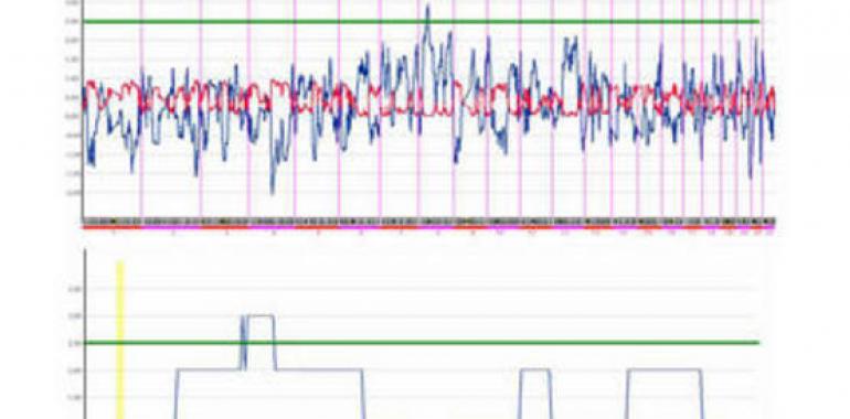 Jornada informativa sobre "soluciones prácticas en el día a día de los pacientes con diabetes"