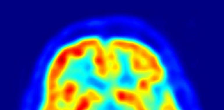 El HUCA está en la vanguardia de la investigación del parkinson