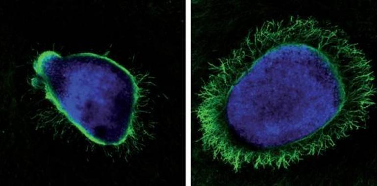 El herpes simple podría abrir nuevas vías para terapias en procesos degenerativos