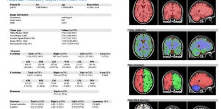 volBrain: análisis on line y gratuito de imágenes de resonancia magnética del cerebro